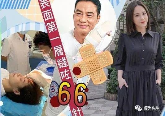 盛世美颜阿娇脸部受伤严重 盛世美颜阿娇脸部受伤严重